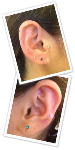 耳つぼ写真